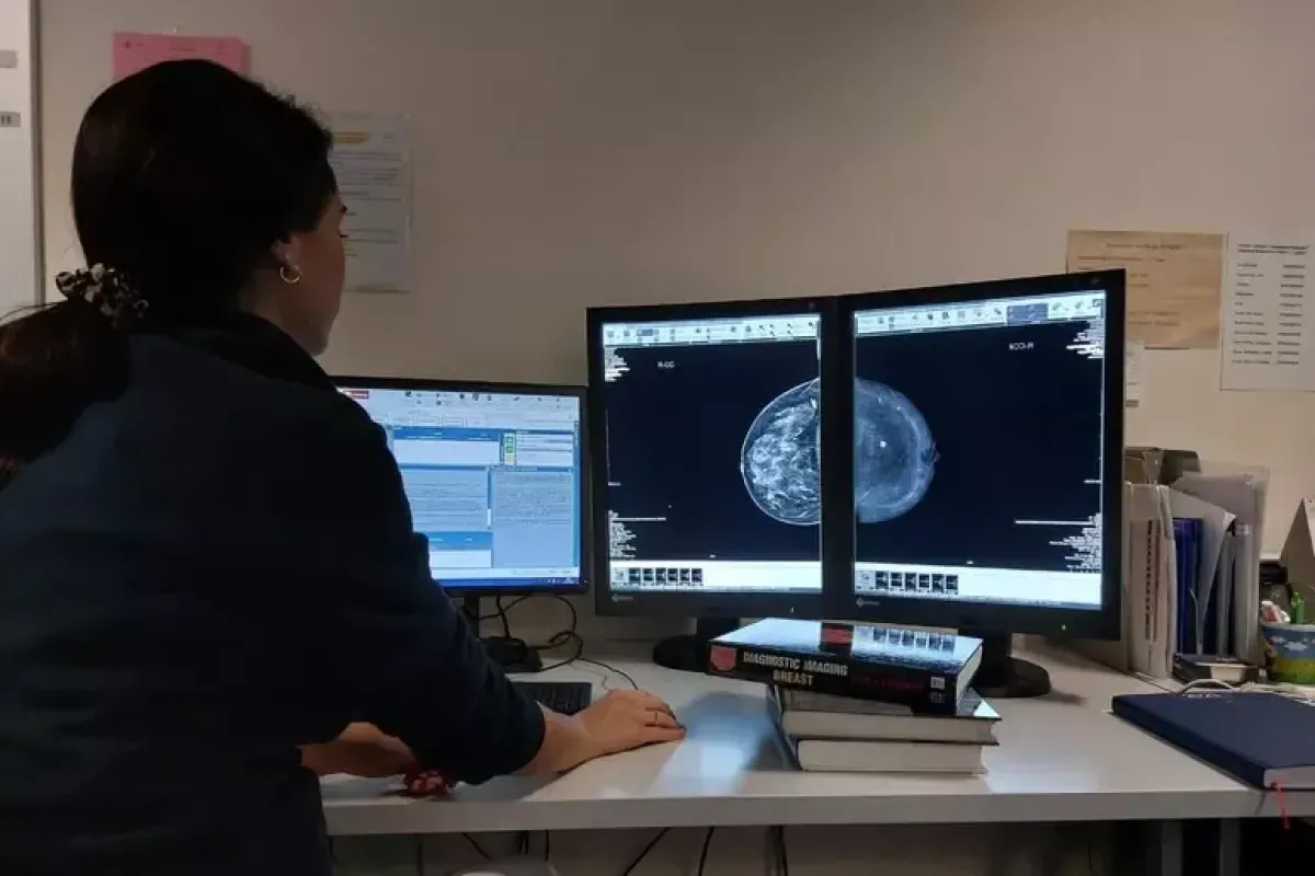 Sanità, in Umbria il 73% aderisce allo screening mammografico: la regione è terza in Italia