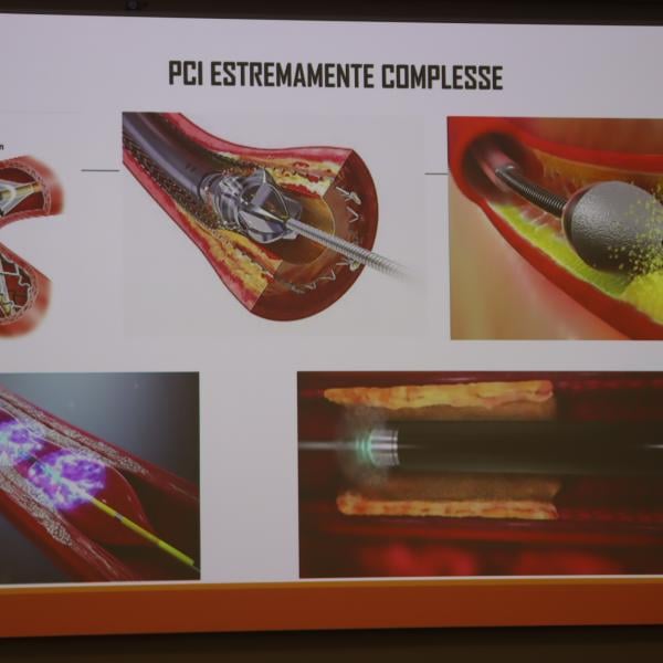 Uno shock cardiaco a settimana, ma metà dei pazienti non arriva in ospedale. Tavolo tecnico della Regione