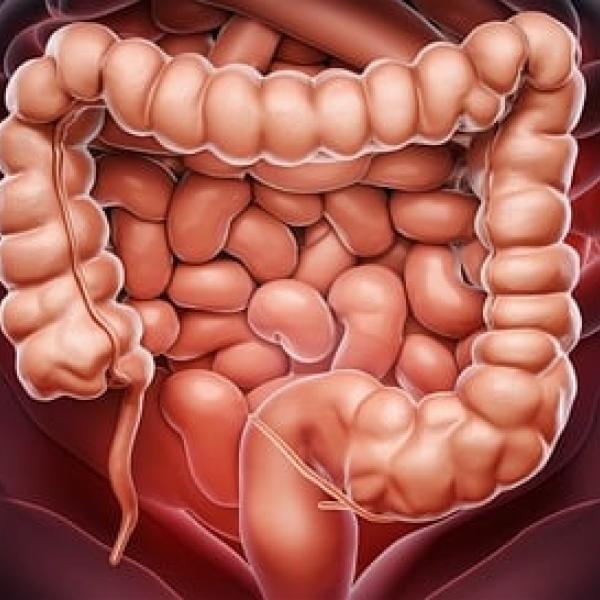 A Foligno dimezzati i tempi di degenza post-operatoria per il tumore al colon