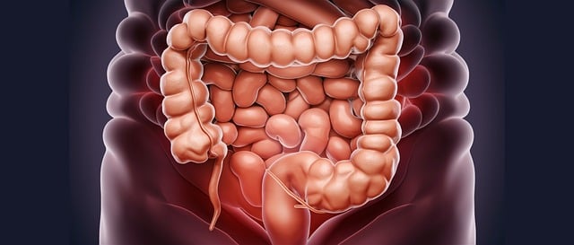 A Foligno dimezzati i tempi di degenza post-operatoria per il tumore al colon